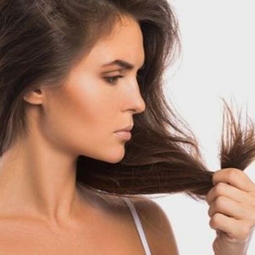 5 Causes of Teenage Hair Loss