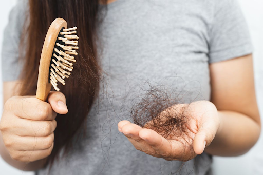 Causes For Hair Loss in Women